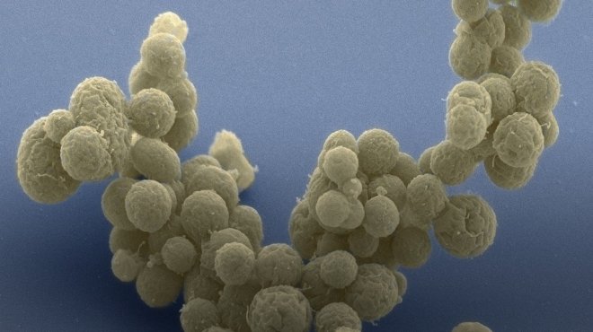 Вчені створили «найпростіший організм»: бактерію з мінімально необхідним дл ...
