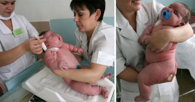 250-кілограмова жінка народила хлопчика. Як думаєте, скільки він важить?