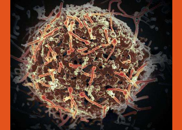 Вірус Ебола зберігся в спермі чоловіка через два роки після одужання